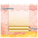 Epidermis,Pulse