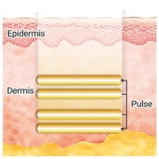 Epidermis,Dermis,Pulse