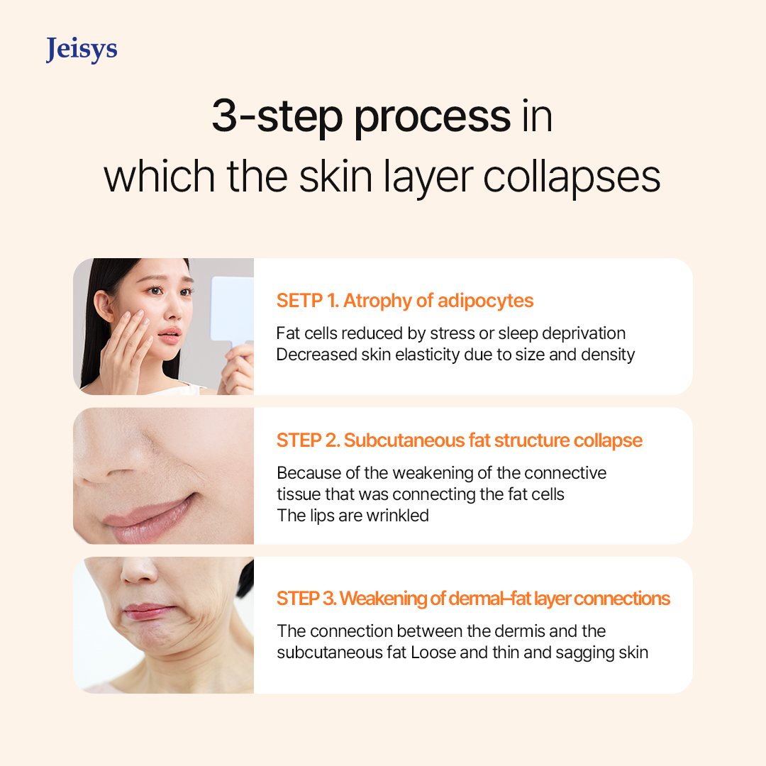 Skin structure illustration